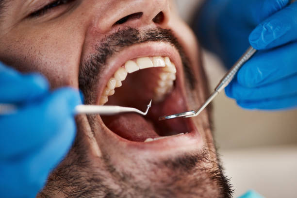 Best Emergency Dental Care for Broken or Chipped Teeth in Bastrop, TX