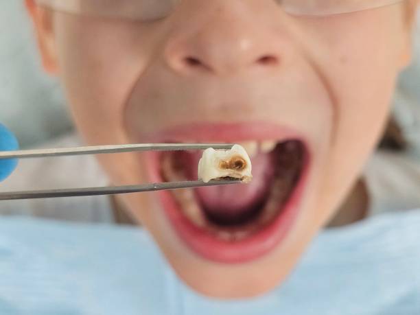 Best Same-Day Emergency Dental Services in Bastrop, TX